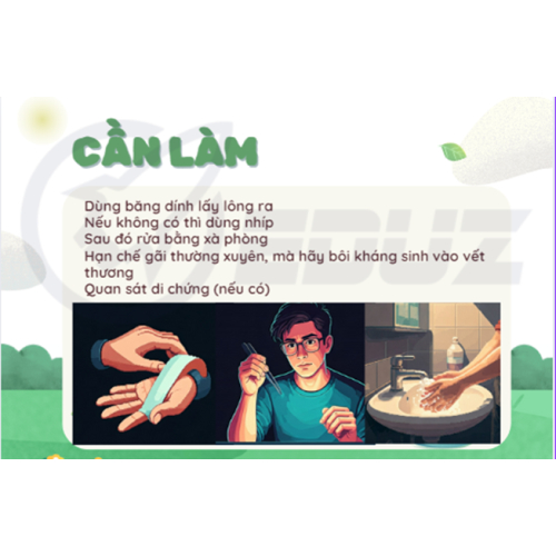 Bạn cần làm